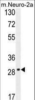 OR9Q1 Antibody - OR9Q1 Antibody western blot of mouse Neuro-2a cell line lysates (35 ug/lane). The OR9Q1 antibody detected the OR9Q1 protein (arrow).