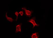 OR9Q1 Antibody - Staining HeLa cells by IF/ICC. The samples were fixed with PFA and permeabilized in 0.1% Triton X-100, then blocked in 10% serum for 45 min at 25°C. The primary antibody was diluted at 1:200 and incubated with the sample for 1 hour at 37°C. An Alexa Fluor 594 conjugated goat anti-rabbit IgG (H+L) Ab, diluted at 1/600, was used as the secondary antibody.