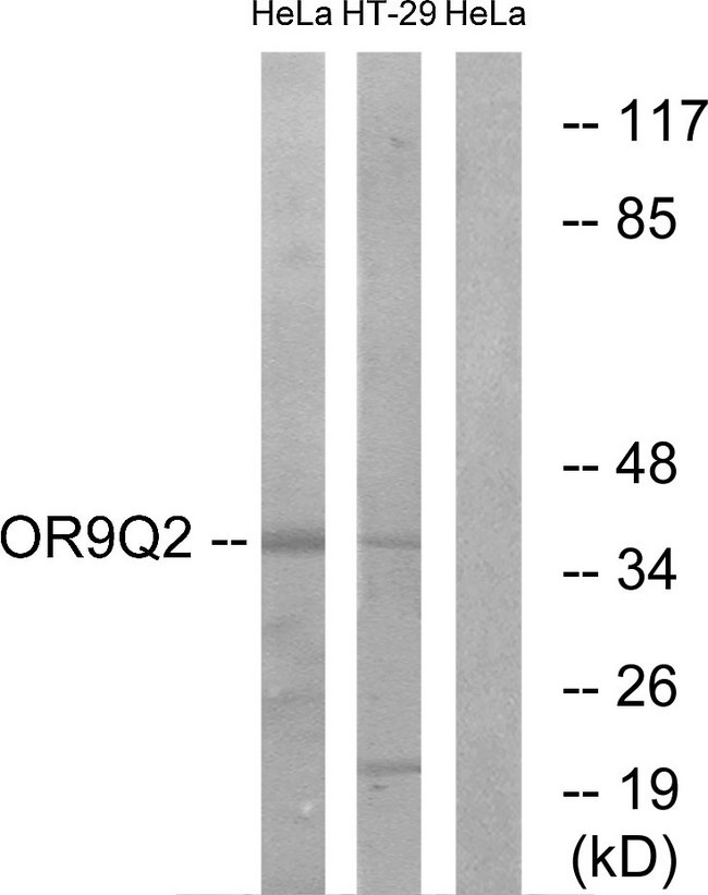 OR9Q2 Antibody - Western blot analysis of lysates from HeLa and HT-29 cells, using OR9Q2 Antibody. The lane on the right is blocked with the synthesized peptide.