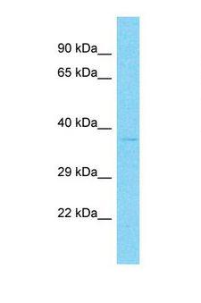 OR9Q2 Antibody - Western blot of Human Fetal Liver. OR9Q2 antibody dilution 1.0 ug/ml.  This image was taken for the unconjugated form of this product. Other forms have not been tested.