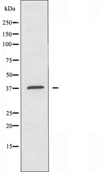 OR9Q2 Antibody - Western blot analysis of extracts of HeLa cells using OR9Q2 antibody.