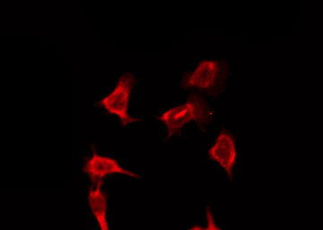 OR9Q2 Antibody - Staining HeLa cells by IF/ICC. The samples were fixed with PFA and permeabilized in 0.1% Triton X-100, then blocked in 10% serum for 45 min at 25°C. The primary antibody was diluted at 1:200 and incubated with the sample for 1 hour at 37°C. An Alexa Fluor 594 conjugated goat anti-rabbit IgG (H+L) Ab, diluted at 1/600, was used as the secondary antibody.