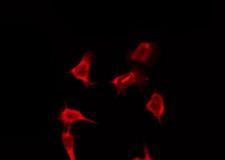 OR9Q2 Antibody - Staining HeLa cells by IF/ICC. The samples were fixed with PFA and permeabilized in 0.1% Triton X-100, then blocked in 10% serum for 45 min at 25°C. The primary antibody was diluted at 1:200 and incubated with the sample for 1 hour at 37°C. An Alexa Fluor 594 conjugated goat anti-rabbit IgG (H+L) Ab, diluted at 1/600, was used as the secondary antibody.