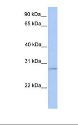 ORAI2 Antibody - MCF7 cell lysate. Antibody concentration: 1.0 ug/ml. Gel concentration: 12%.  This image was taken for the unconjugated form of this product. Other forms have not been tested.