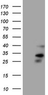ORAI2 Antibody - HEK293T cells were transfected with the pCMV6-ENTRY control. (Left lane) or pCMV6-ENTRY ORAI2. (Right lane) cDNA for 48 hrs and lysed. Equivalent amounts of cell lysates. (5 ug per lane) were separated by SDS-PAGE and immunoblotted with anti-ORAI2. (1:500)