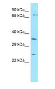 ORAI3 Antibody - ORAI3 antibody Western Blot of MCF7.  This image was taken for the unconjugated form of this product. Other forms have not been tested.