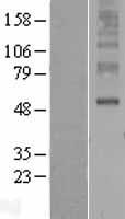 ORAI3 Protein - Western validation with an anti-DDK antibody * L: Control HEK293 lysate R: Over-expression lysate