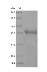 GPX4 / MCSP Protein - (Tris-Glycine gel) Discontinuous SDS-PAGE (reduced) with 5% enrichment gel and 15% separation gel.