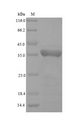 GPX4 / MCSP Protein - (Tris-Glycine gel) Discontinuous SDS-PAGE (reduced) with 5% enrichment gel and 15% separation gel.