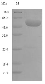 MTHFD1 Protein - (Tris-Glycine gel) Discontinuous SDS-PAGE (reduced) with 5% enrichment gel and 15% separation gel.