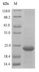 TMEM168 Protein - (Tris-Glycine gel) Discontinuous SDS-PAGE (reduced) with 5% enrichment gel and 15% separation gel.