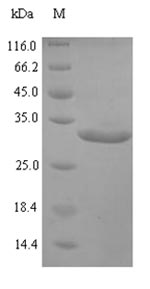 TTR / Transthyretin Protein - (Tris-Glycine gel) Discontinuous SDS-PAGE (reduced) with 5% enrichment gel and 15% separation gel.