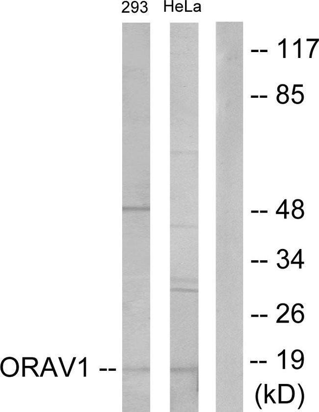 ORAOV1 Antibody - Western blot analysis of lysates from 293 and HeLa cells, using ORAV1 Antibody. The lane on the right is blocked with the synthesized peptide.