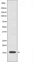 ORAOV1 Antibody - Western blot analysis of extracts of 293 cells using ORAV1 antibody.
