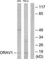 ORAOV1 Antibody - Western blot analysis of extracts from 293 cells and HeLa cells, using ORAV1 antibody.
