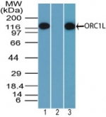 ORC1 Antibody - Western blot of ORC1L in Daudi cell lysate in the 1) absence and 2) presence of immunizing peptide and in 3) NIH 3T3 cell lysate using Polyclonal Antibody to ORC1L at 2 ug/ml. Goat anti-rabbit Ig HRP secondary antibody, and PicoTect ECL substrate solution, were used for this test.