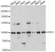 ORC1 Antibody - Western blot analysis of extracts of various cell lines, using ORC1 antibody at 1:1000 dilution. The secondary antibody used was an HRP Goat Anti-Rabbit IgG (H+L) at 1:10000 dilution. Lysates were loaded 25ug per lane and 3% nonfat dry milk in TBST was used for blocking. An ECL Kit was used for detection and the exposure time was 10s.