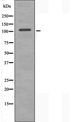 ORC1 Antibody - Western blot analysis of extracts of HepG2 cells using ORC1L antibody.
