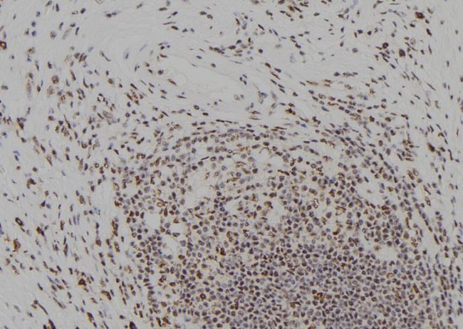 ORC2L / ORC2 Antibody - 1:100 staining human gastric tissue by IHC-P. The sample was formaldehyde fixed and a heat mediated antigen retrieval step in citrate buffer was performed. The sample was then blocked and incubated with the antibody for 1.5 hours at 22°C. An HRP conjugated goat anti-rabbit antibody was used as the secondary.
