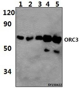 ORC3L / ORC3 Antibody - Western blot of ORC3 antibody at 1:1000 dilution. Lane 1: HEK293T whole cell lysate (56.7ug). Lane 2: HELA whole cell lysate (51.3ug). Lane 3: A549 whole cell lysate (57.6ug). Lane 4: H9C2 whole cell lysate (56.1ug). Lane 5: Raw264.7 whole cell lysate (51ug).