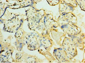 ORC4L / ORC4 Antibody - Immunohistochemistry of paraffin-embedded human placenta tissue using antibody at 1:100 dilution.