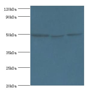 ORC4L / ORC4 Antibody - Western blot. All lanes: ORC4 antibody at 4 ug/ml. Lane 1: HeLa whole cell lysate. Lane 2: Jurkat whole cell lysate. Lane 3: A549 whole cell lysate. Secondary antibody: Goat polyclonal to rabbit at 1:10000 dilution. Predicted band size: 50 kDa. Observed band size: 50 kDa.