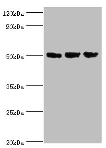 ORC4L / ORC4 Antibody - Western blot All lanes: ORC4 antibody at 4µg/ml Lane 1: Hela whole cell lysate Lane 2: Jurkat whole cell lysate Lane 3: A549 whole cell lysate Secondary Goat polyclonal to rabbit IgG at 1/10000 dilution Predicted band size: 51, 41, 43 kDa Observed band size: 51 kDa