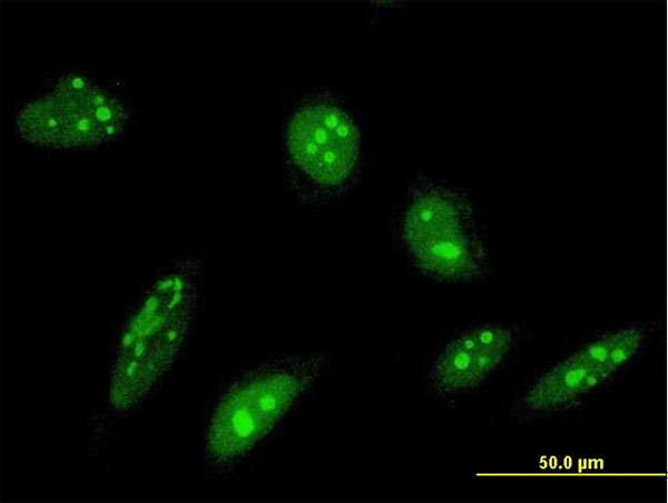 ORC4L / ORC4 Antibody - Immunofluorescence of monoclonal antibody to ORC4L on HeLa cell . [antibody concentration 10 ug/ml]