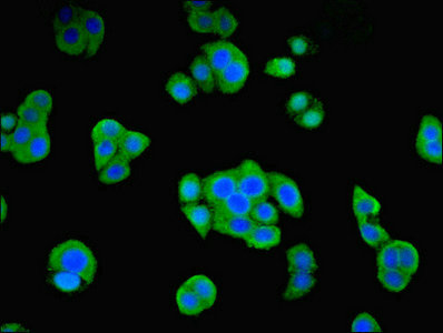 ORC4L / ORC4 Antibody - Immunofluorescent analysis of PC-3 cells using ORC4 Antibody at dilution of 1:100 and Alexa Fluor 488-congugated AffiniPure Goat Anti-Rabbit IgG(H+L)