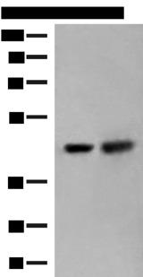 ORC4L / ORC4 Antibody - Western blot analysis of HepG2 and Hela cell lysates  using ORC4 Polyclonal Antibody at dilution of 1:550
