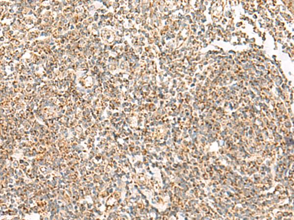 ORC4L / ORC4 Antibody - Immunohistochemistry of paraffin-embedded Human tonsil tissue  using ORC4 Polyclonal Antibody at dilution of 1:70(×200)
