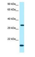 ORC5 Antibody - ORC5 antibody Western Blot of Fetal Heart.  This image was taken for the unconjugated form of this product. Other forms have not been tested.