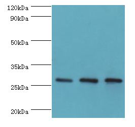 ORC6 / ORC6L Antibody - Western blot. All lanes: ORC6 antibody at 16 ug/ml. Lane 1: mouse spleen tissue. Lane 2: MCF-7 whole cell lysate. Lane 3: HeLa whole cell lysate. Secondary antibody: Goat polyclonal to rabbit at 1:10000 dilution. Predicted band size: 28 kDa. Observed band size: 28 kDa.