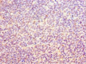 ORC6 / ORC6L Antibody - Immunohistochemistry of paraffin-embedded human tonsil tissue using antibody at 1:100 dilution.