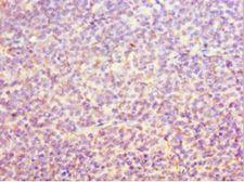 ORC6 / ORC6L Antibody - Immunohistochemistry of paraffin-embedded human tonsil tissue using antibody at 1:100 dilution.