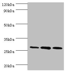 ORC6 / ORC6L Antibody - Western blot All lanes: ORC6 antibody at 16µg/ml Lane 1: Mouse spleen tissue Lane 2: MCF-7 whole cell lysate Lane 3: Hela whole cell lysate Secondary Goat polyclonal to rabbit IgG at 1/10000 dilution Predicted band size: 28 kDa Observed band size: 28 kDa