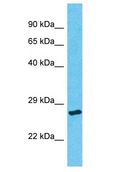 ORC6 / ORC6L Antibody - ORC6 / ORC6L antibody Western Blot of Thyroid Tumor. Antibody dilution: 1 ug/ml.  This image was taken for the unconjugated form of this product. Other forms have not been tested.