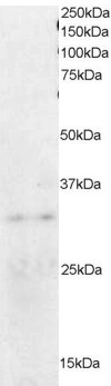 ORC6 / ORC6L Antibody - Antibody staining (0.2 ug/ml) of HeLa lysate (RIPA buffer, 35 ug total protein per lane). Primary incubated for 1 hour. Detected by Western blot of chemiluminescence.
