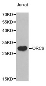 ORC6 / ORC6L Antibody - Western blot analysis of extracts of Jurkat cell line, using ORC6 antibody.