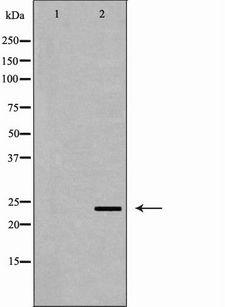 ORM1 / Orosomucoid Antibody - Western blot analysis of HepG2 cell lysates using ORM1 antibody. The lane on the left is treated with the antigen-specific peptide.
