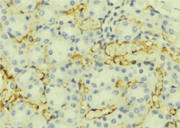 ORM1 / Orosomucoid Antibody - 1:100 staining mouse liver tissue by IHC-P. The sample was formaldehyde fixed and a heat mediated antigen retrieval step in citrate buffer was performed. The sample was then blocked and incubated with the antibody for 1.5 hours at 22°C. An HRP conjugated goat anti-rabbit antibody was used as the secondary.
