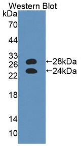 ORM1 / Orosomucoid Antibody - Western Blot; Sample: Recombinant protein.