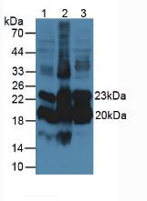 ORM1 / Orosomucoid Antibody