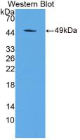 ORM1 / Orosomucoid Antibody