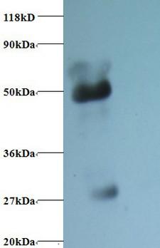 ORM1 / Orosomucoid Antibody - Western blot of alpha 1-acid glycoprotein antibody at 2 ug/ml + Human serum at 1:50. Secondary: Goat polyclonal to Rabbit IgG at 1:10000 dilution.  This image was taken for the unconjugated form of this product. Other forms have not been tested.