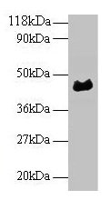 ORM1 / Orosomucoid Antibody - Western blot All lanes: a1-acidglycoprotein antibody at 2µg/ml + Human serum at 1: 50 Secondary Goat polyclonal to rabbit IgG at 1/10000 dilution Predicted band size: 45 kDa Observed band size: 45 kDa