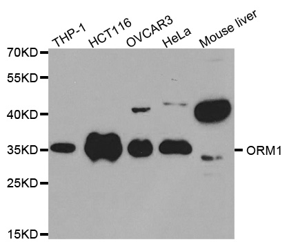 ORM1 / Orosomucoid Antibody - Western blot analysis of extracts of various cell lines.