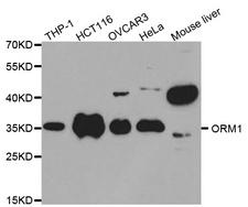 ORM1 / Orosomucoid Antibody - Western blot analysis of extracts of various cell lines.