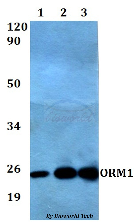 ORM1 / Orosomucoid Antibody - Western blot of ORM1 antibody at 1:500 dilution. Lane 1: MCF-7 whole cell lysate. Lane 2: Raw264.7 whole cell lysate. Lane 3: H9C2 whole cell lysate.