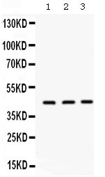 ORM1 / Orosomucoid Antibody - Western blot - Anti-AGP1/alpha 1 acid glycoprotein Picoband Antibody